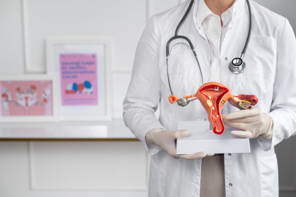 পলিসিস্টিক ওভারিয়ান সিনড্রোম (PCOS)
