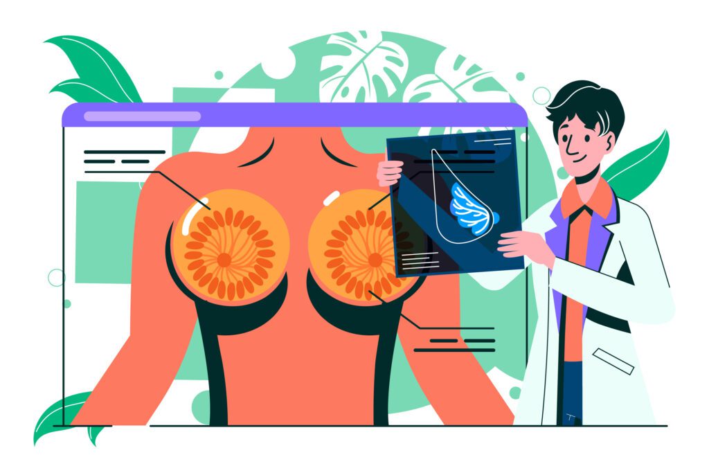 স্তনের প্যাজেট রোগ
