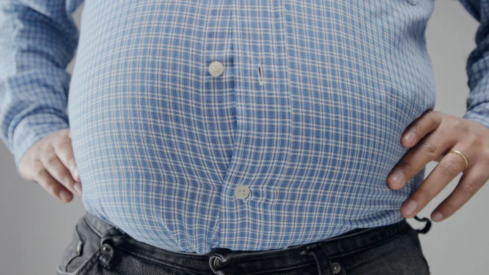 Causes and health risks of obesity
